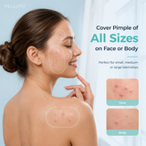 Pellure Acne Patch Variety Pack — 443 Count, 5 Sizes
